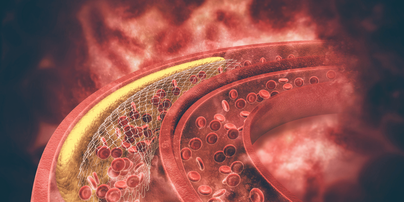 Worried about Cholesterol? Learn how to manage it naturally. - Nummies